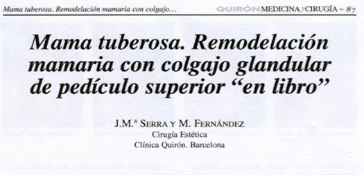 Reducci&oacute;n Mamaria