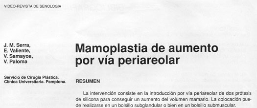 Aumento mamario periareolar