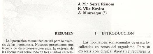 Liposuccion para el tratamiento de las lipomatosis