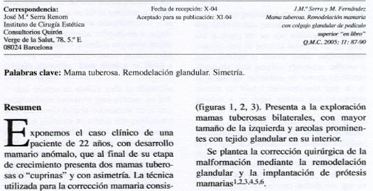 Reducci&oacute;n Mamaria