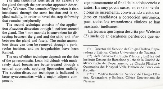 Ginecomastia con tecnica de Liposuccion